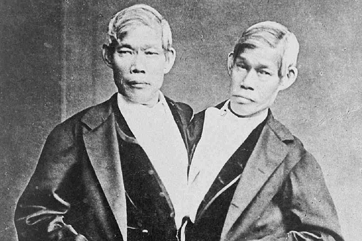 La storia dei gemelli siamesi Chang ed Eng Bunker